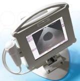 Mediwatch multiscan PVR Ultrsound - inCAV Medical Imaging Equipment