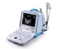 Mindray DP 3300 Portable Ultrasound Machine - inCAV Medical Imaging Equipment