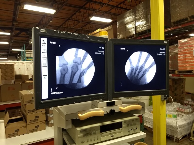 Philips BV Pulsera C - ARM 2004 2nd Generation with Flat Pannel Monitors - inCAV Medical Imaging Equipment