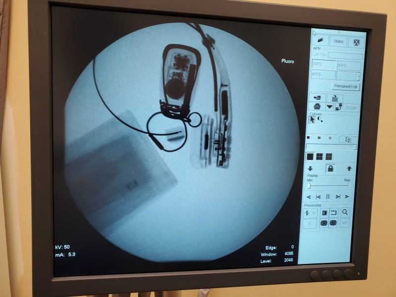 Shimadzu Sonialvision Versa 2015 WIT DAR - 8000i, ZS - 100IR Fluoroscopy / Rad Room - inCAV Medical Imaging Equipment
