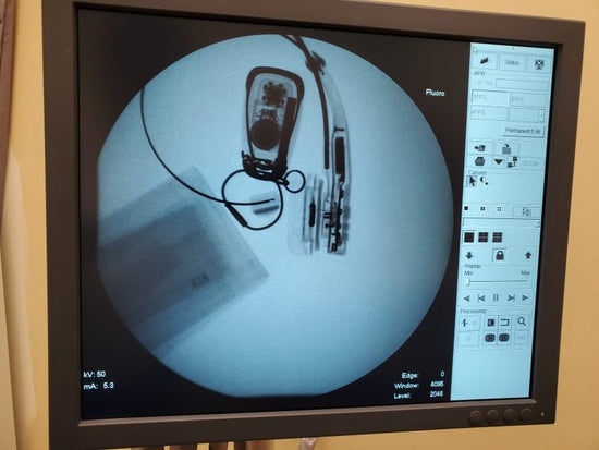 Shimadzu Sonialvision Versa 2015 WIT DAR-8000i, ZS-100IR