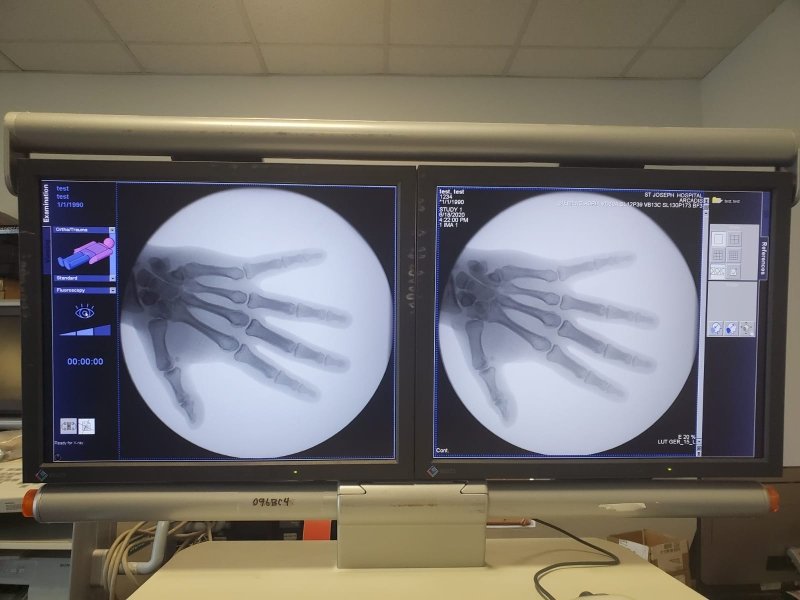 Siemens ARCADIS Orbic 2005 with COLOR LCD Monitors - inCAV Medical Imaging Equipment