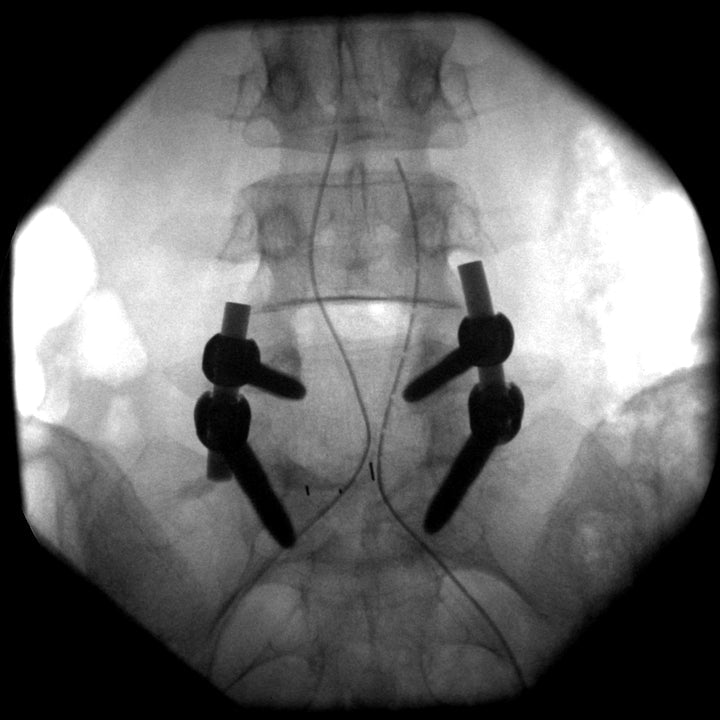 Siemens ARCADIS Orbic 3D 2008 with 190º orbital movement. BrainLAB NaviVIsion - inCAV Medical Imaging Equipment