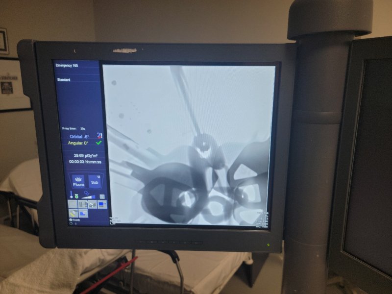 Siemens CiOS Alpha 2015 with 20x20 Flat Pannel Detector - inCAV Medical Imaging Equipment