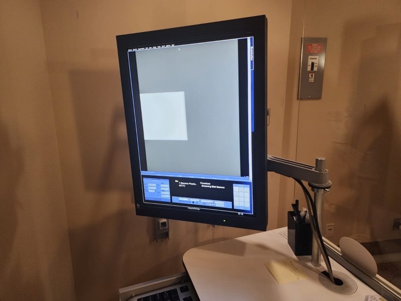Siemens Mammomat Inspiration with PRIME Technology - 2011 - inCAV Medical Imaging Equipment
