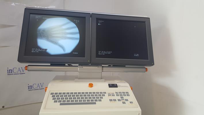 Siemens SIREMOBIL Compact L 2007 with LCD Monitors - inCAV Medical Imaging Equipment