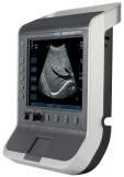 Sonosite S Nerve portable ultrasound machine - inCAV Medical Imaging Equipment