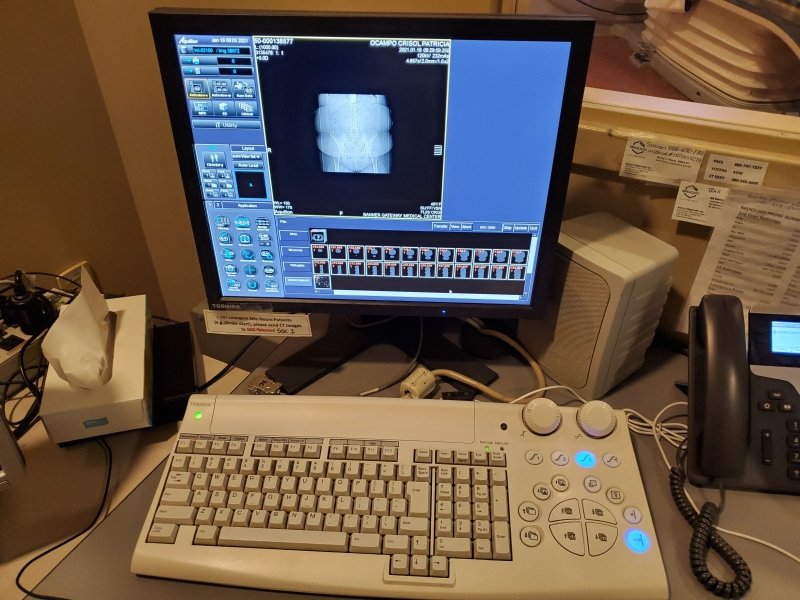 Toshiba Aquilion 32 - 64 Slice CT Scanner 2007 with 2015 Tube - SYSTEM updated by Toshiba 2015 - inCAV Medical Imaging Equipment
