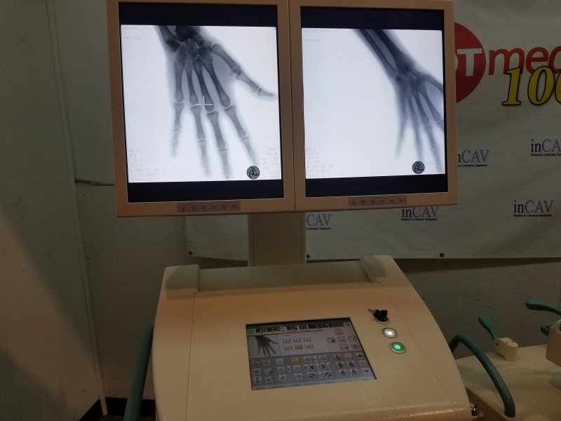 Ziehm Vision RFD 2010 with Flat Panel - inCAV Medical Imaging Equipment