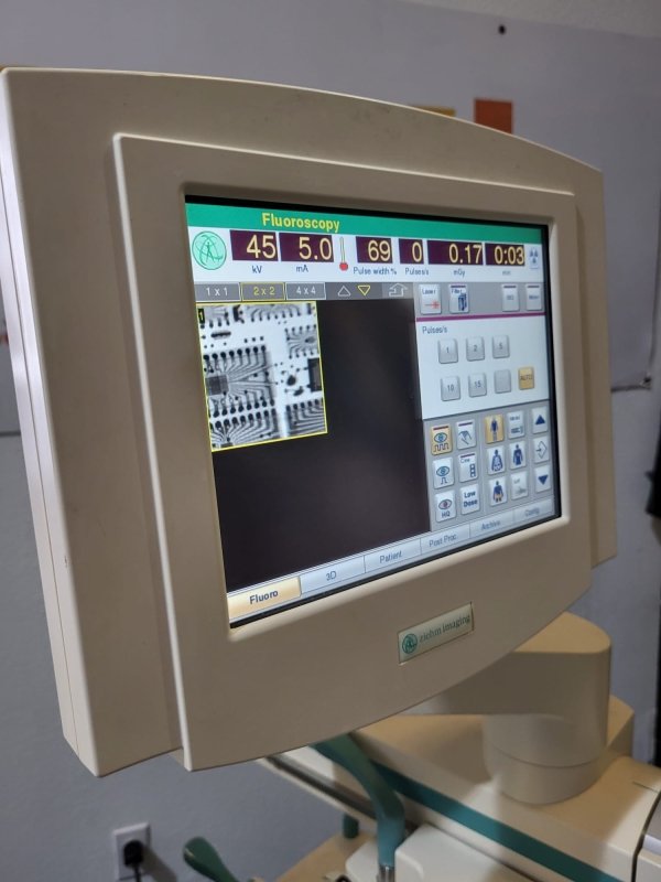 Ziehm Vision Vario 3D with Flat Pannel Detector FD - 2011 - inCAV Medical Imaging Equipment
